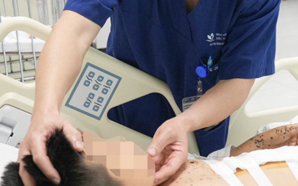 Bé trai 9 tuổi nguy kịch vì kíp nổ tự chế: Cảnh báo từ Bệnh viện Nhi Trung ương