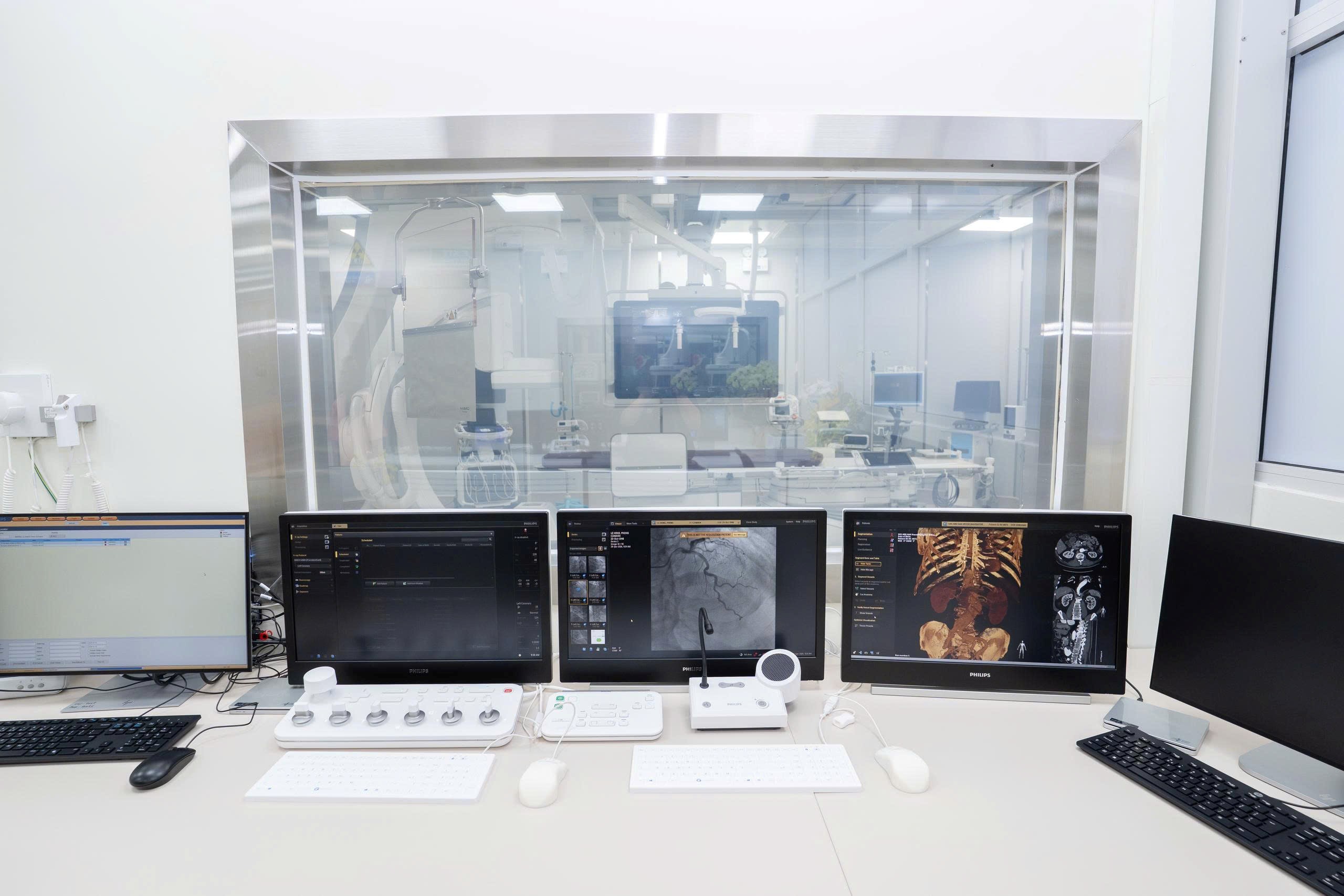 Hệ thống thông tim can thiệp hiện đại Bệnh viện Chợ Rẫy: Bước tiến cho những “nhịp đập” tương lai- Ảnh 3.