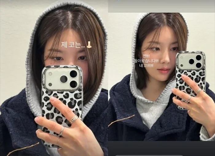 Nữ ca sĩ bị bỏng da độ 2 khi leo núi, khiến fan bàng hoàng - Ảnh 2.