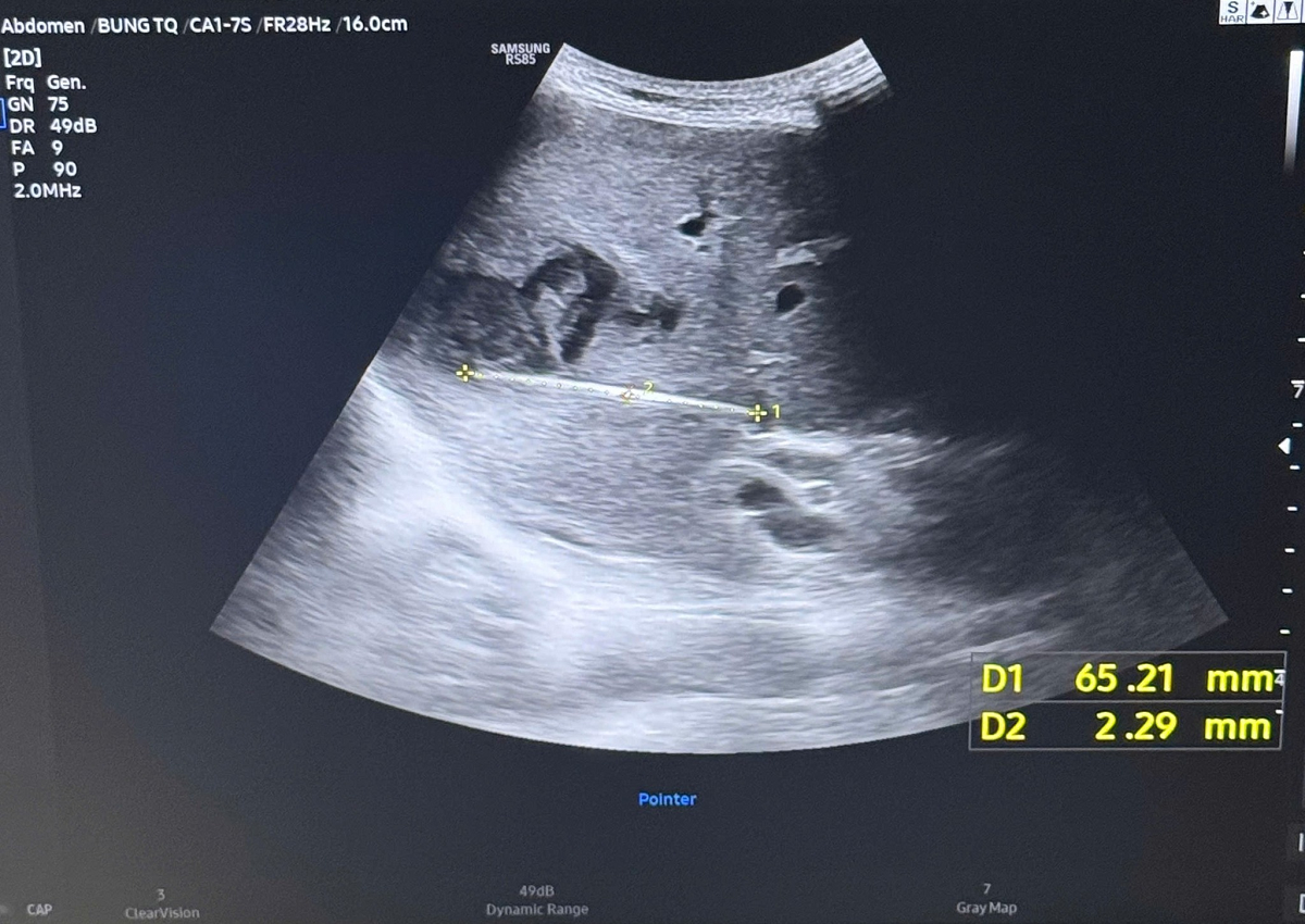 Người đàn ông đau bụng kéo dài, bác sĩ sốc khi phát hiện bí mật bên trong - Ảnh 1.