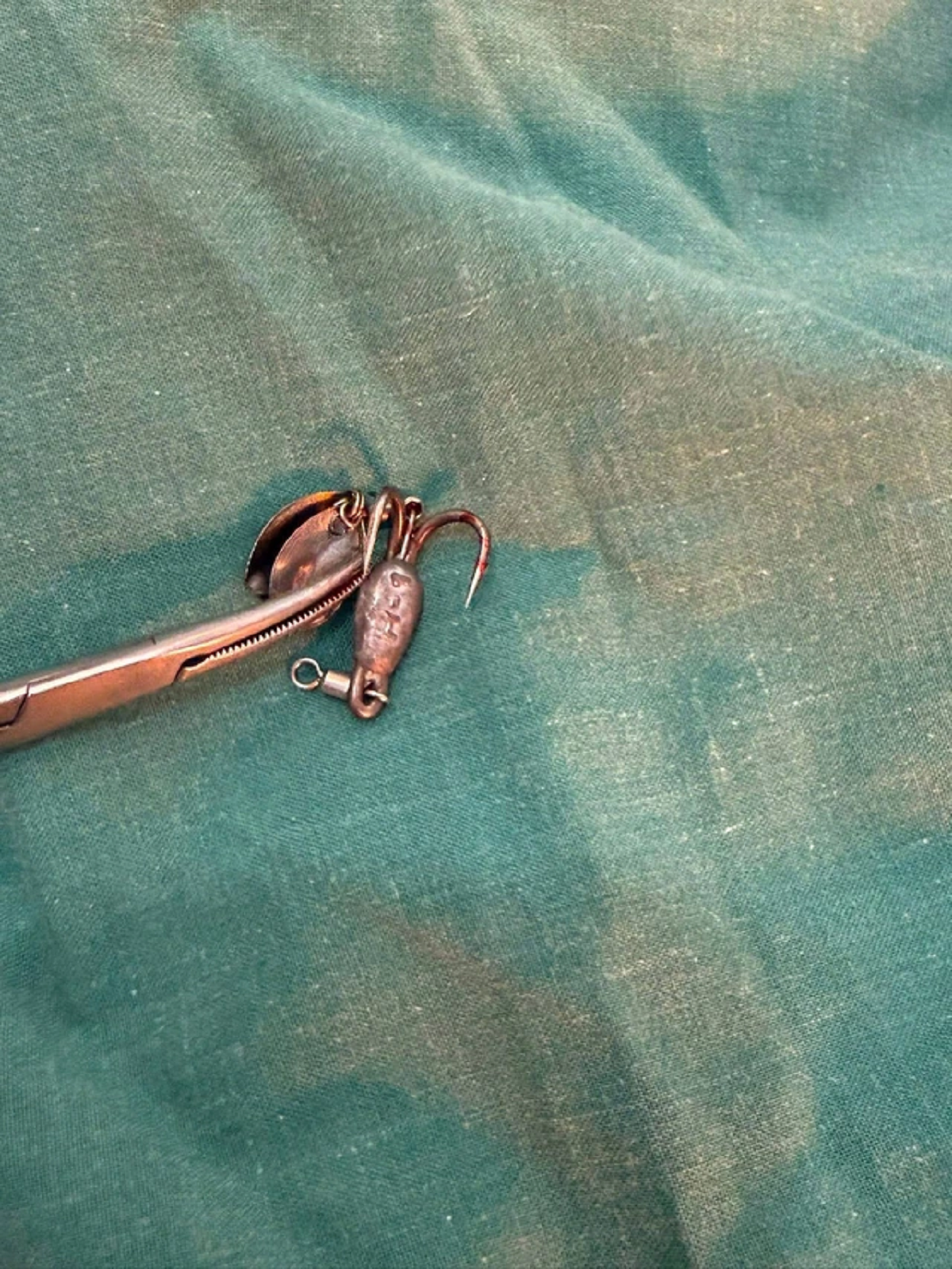 Bé trai 13 tuổi chảy máu nhiều, bác sĩ sốc khi phát hiện bí mật "đáng sợ" ở cổ - Ảnh 2.