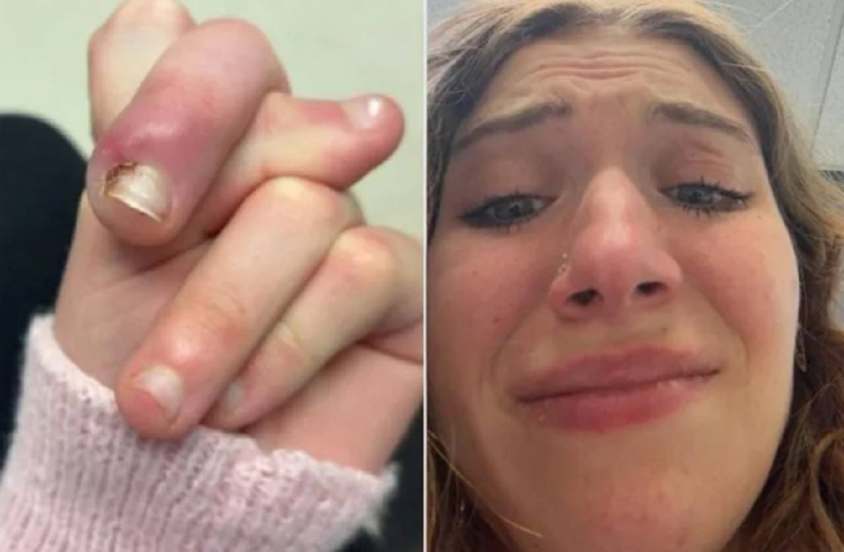 Người phụ nữ 21 tuổi suýt mất ngón vì thói quen "vạn người mê" - Ảnh 1.