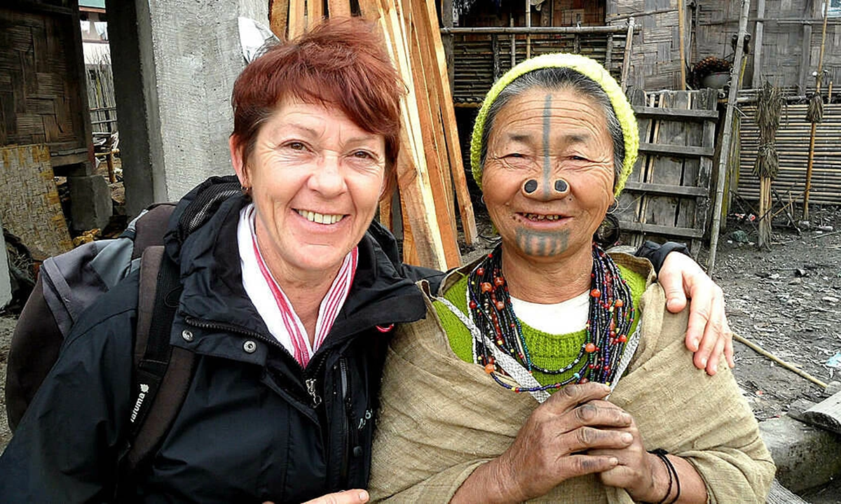 Làm đẹp kinh dị: 