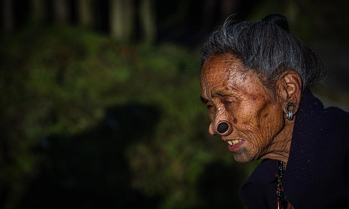 Làm đẹp kinh dị: 