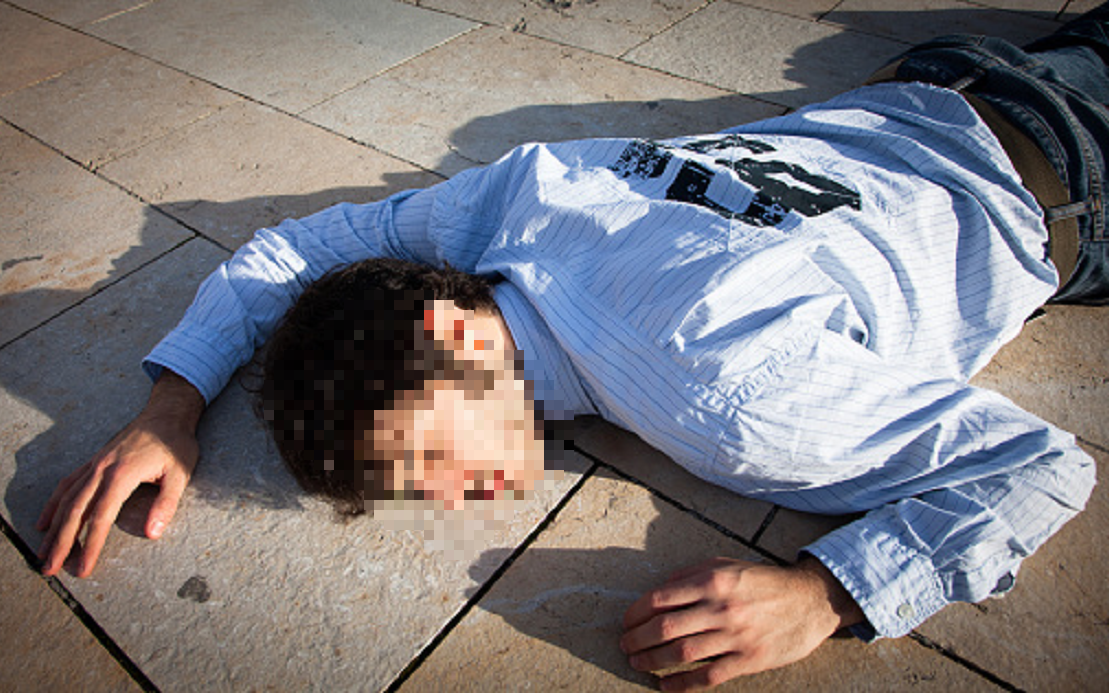 Bàn tay mắc kẹt trong máy xay thịt, người phụ nữ trẻ sốc khi phải cắt cụt chi - Ảnh 2.