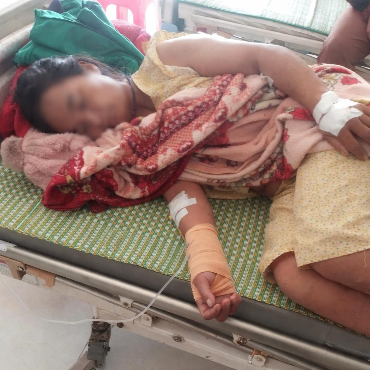 Ăn cá ủ chua người thân tặng, người phụ nữ 54 tuổi bụng 