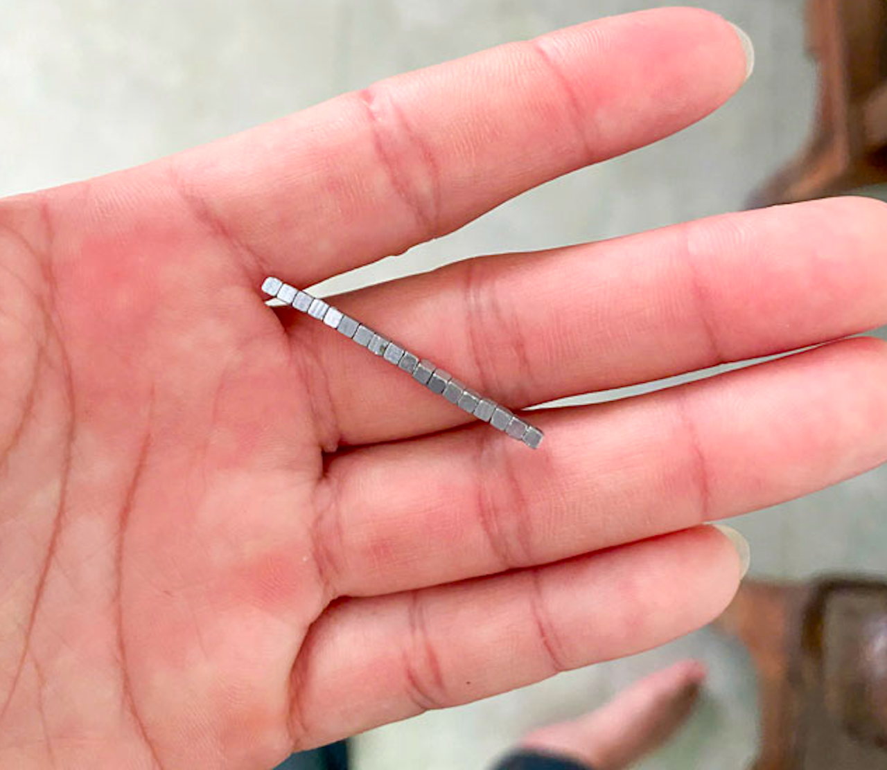 Bé trai 5 tuổi nuốt hàng chục viên nam châm gây thủng ruột - Ảnh 2.