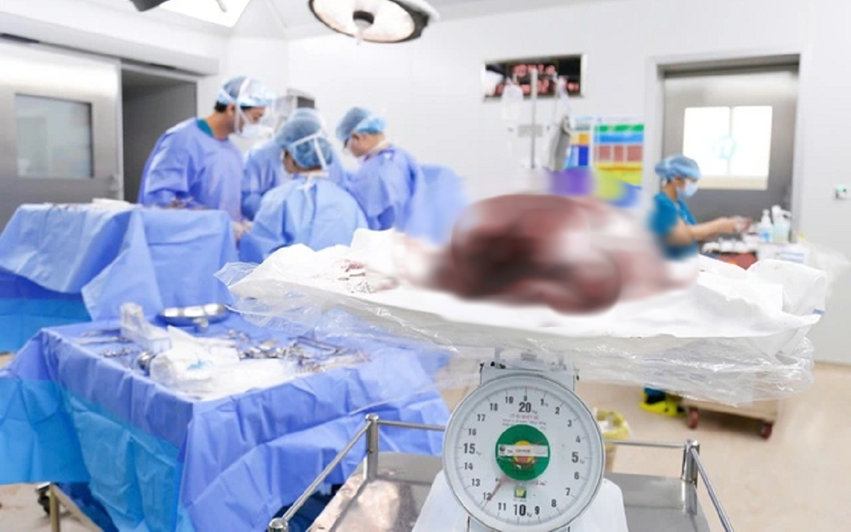 Bệnh viện Từ Dũ phẫu thuật thành công khối u xơ tử cung nặng gần 12 kg, bảo tồn tử cung