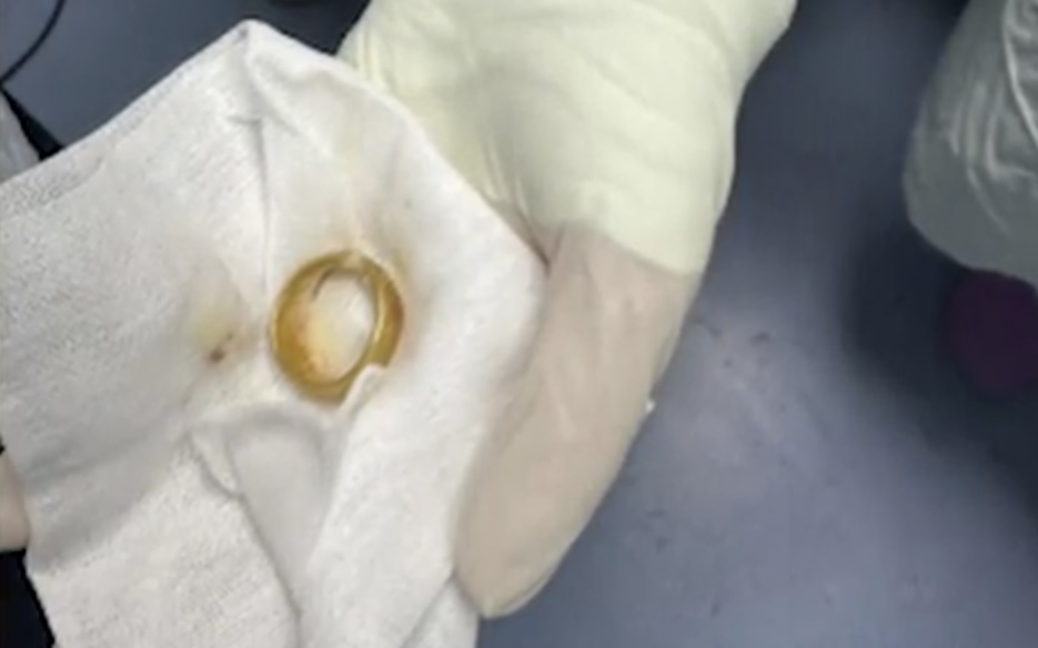 Nhờ người truyền dịch tại nhà, hai người phụ nữ ở Phú Thọ nguy kịch - Ảnh 2.