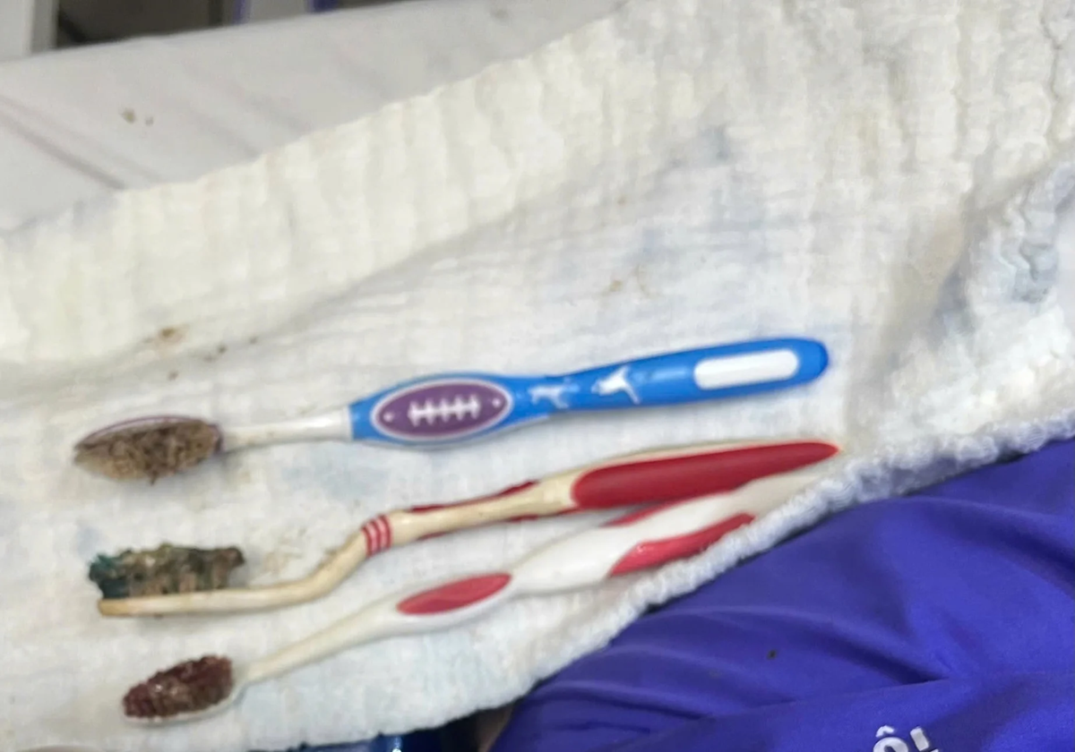 Nam thanh niên 29 tuổi đau bụng, bác sĩ lấy ra thứ