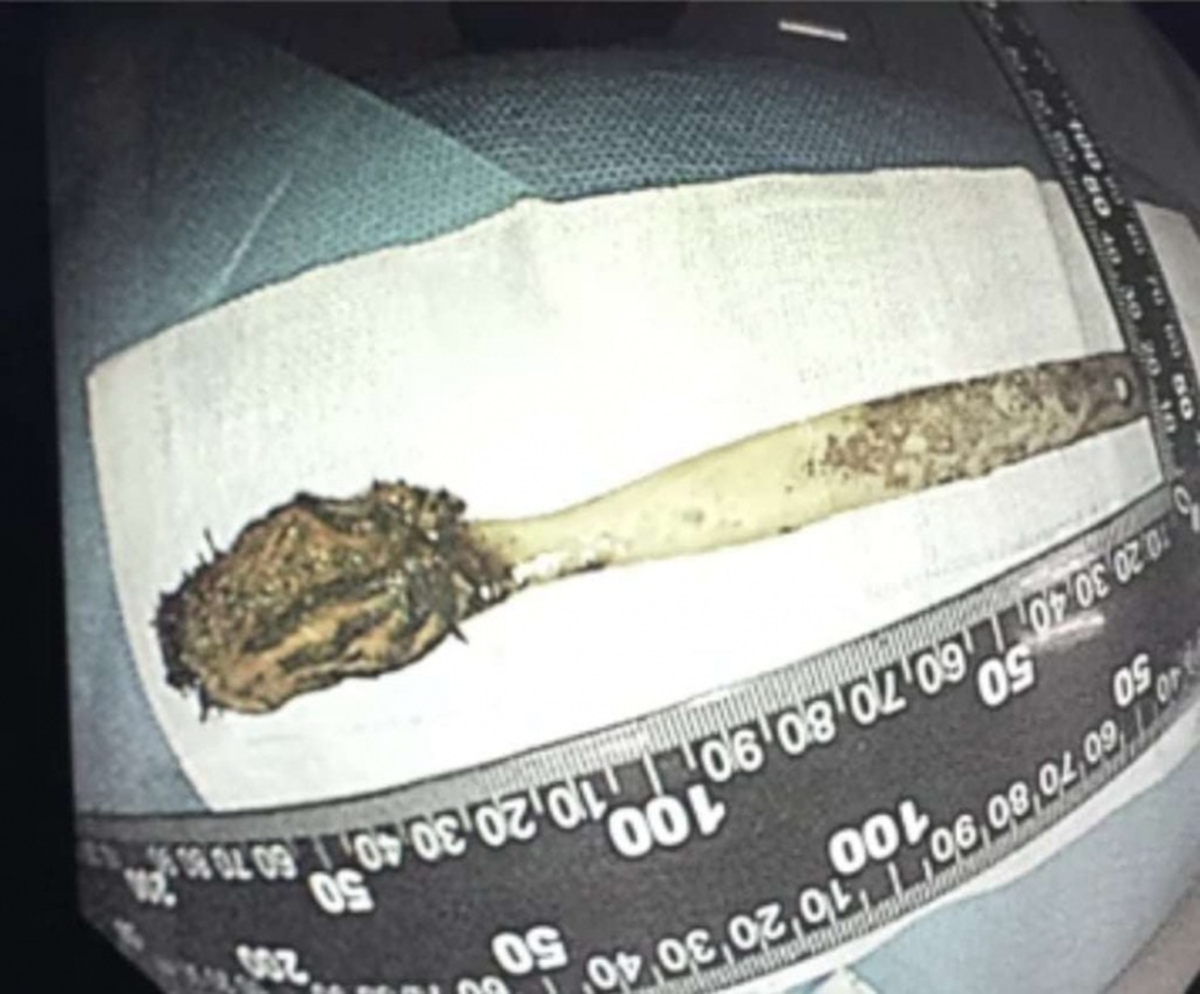 Đau bụng đi khám, người đàn ông 