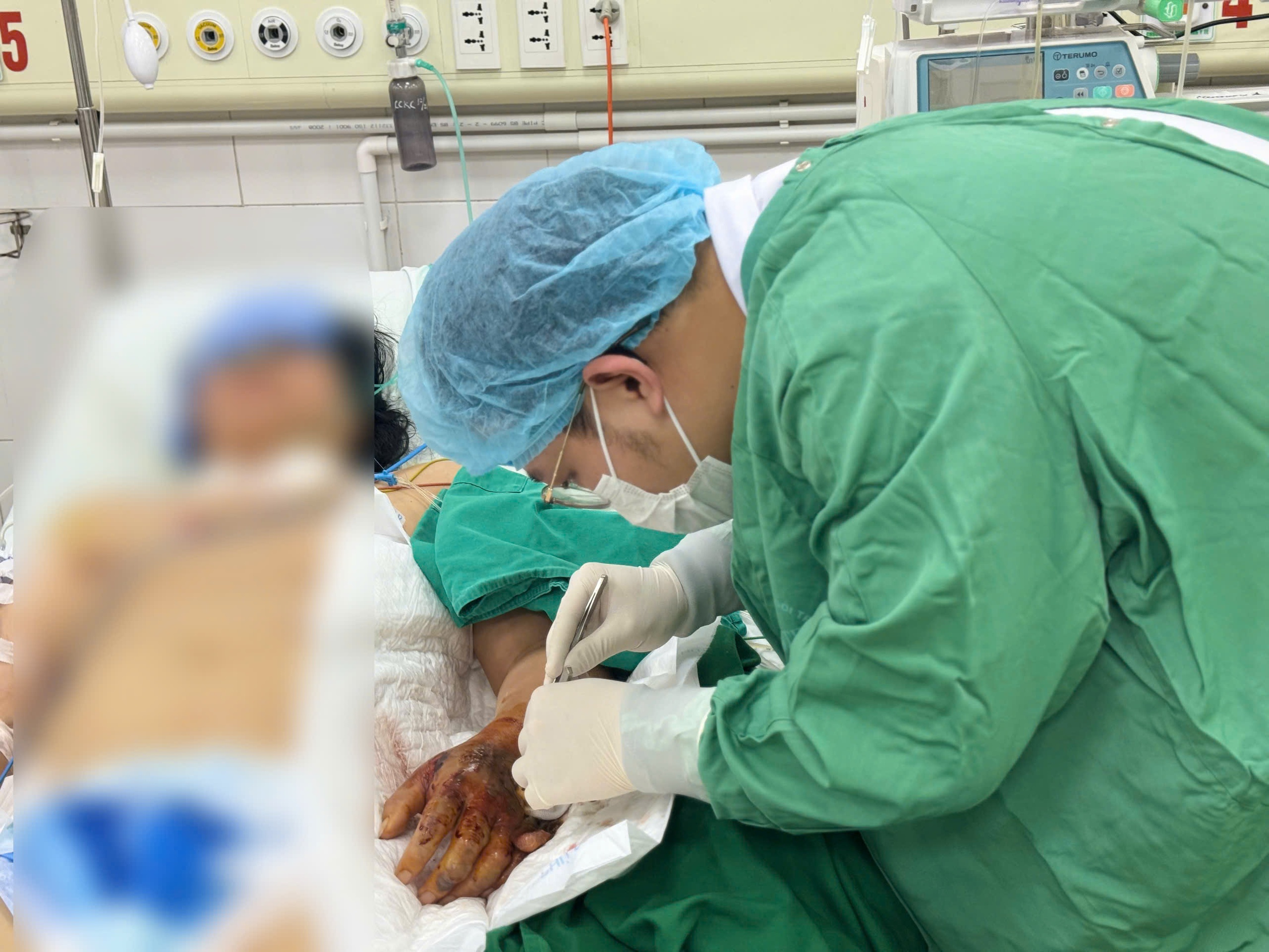 Tiêm hỗ trợ xương khớp, bệnh nhân sốc nhiễm khuẩn nguy kịch- Ảnh 1.