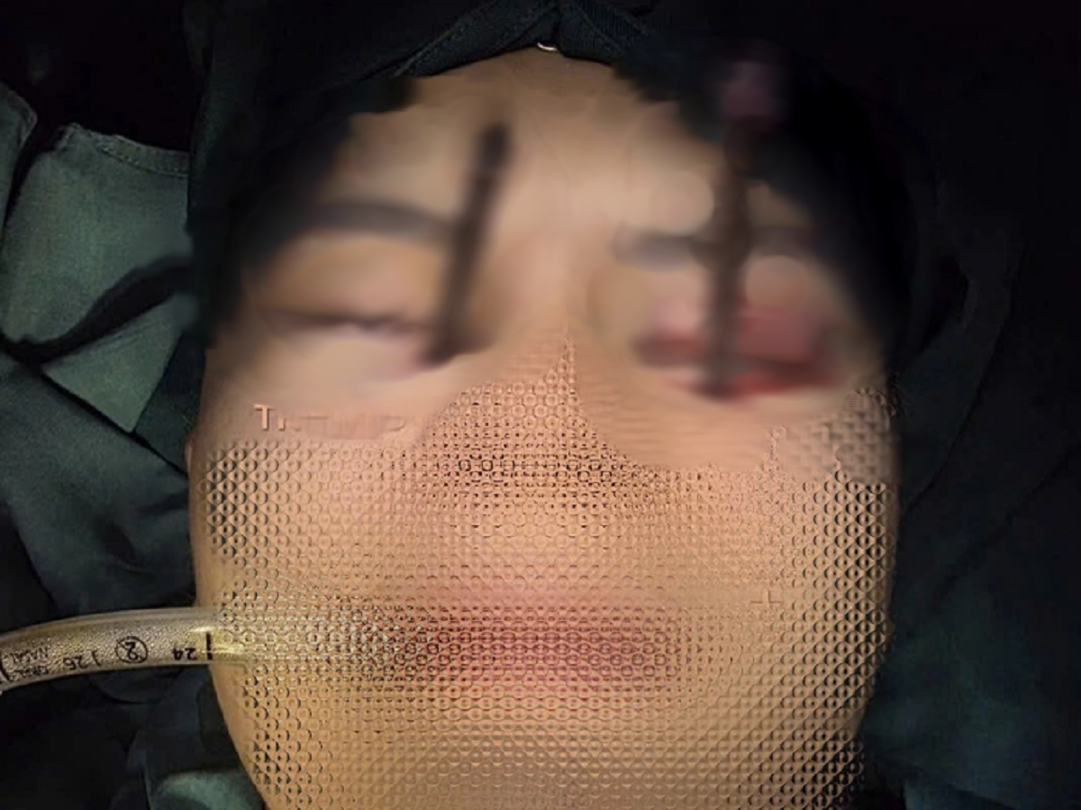 Chàng trai 25 tuổi đau mắt dữ dội, bác sĩ phát hiện bí mật 