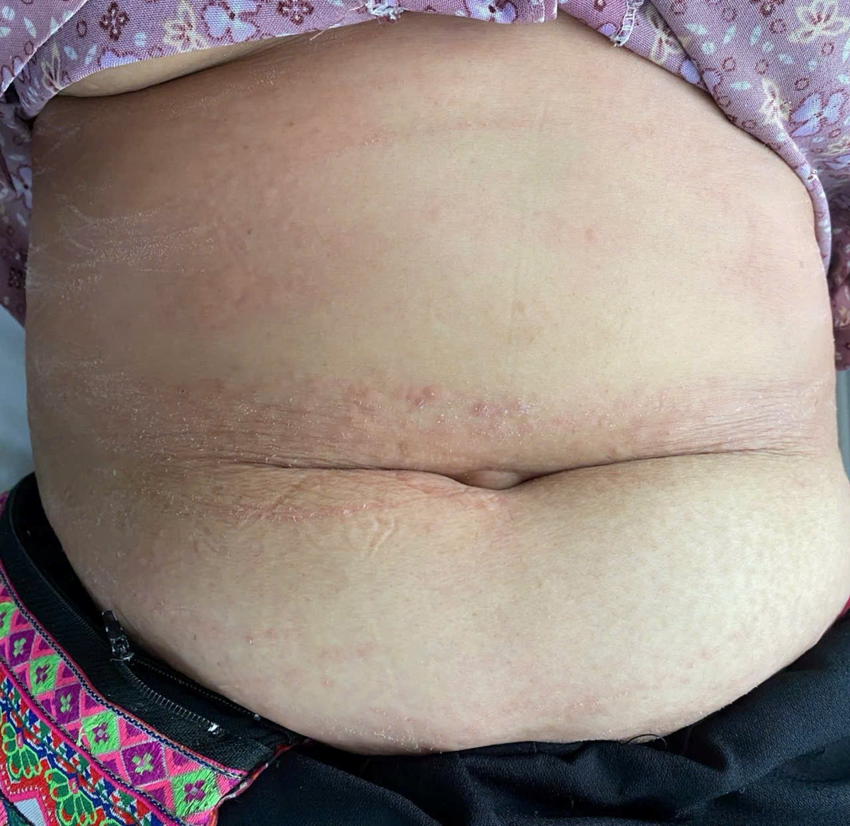 Đi tảo mộ, 8 người nhập viện gấp vì điều này - Ảnh 1.