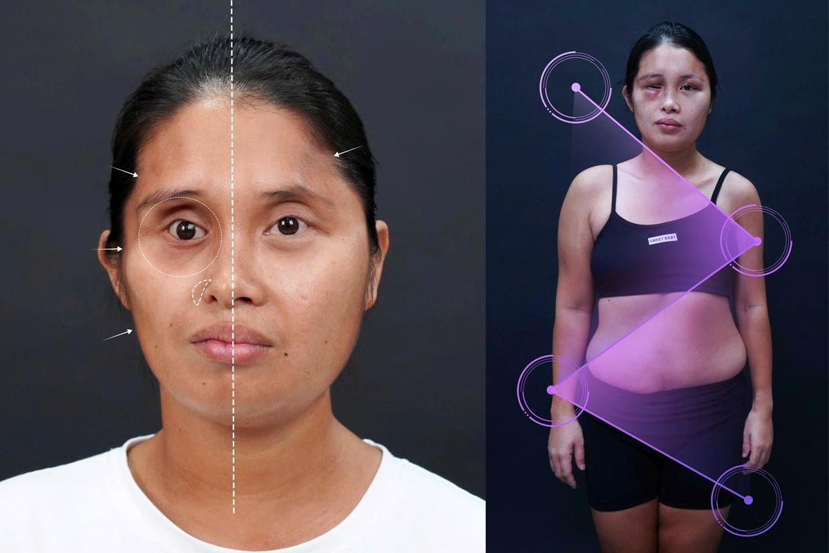 Hành trình tìm lại chính mình của cô gái già trước tuổi 30 do đột biến hiếm gặp - Ảnh 2.