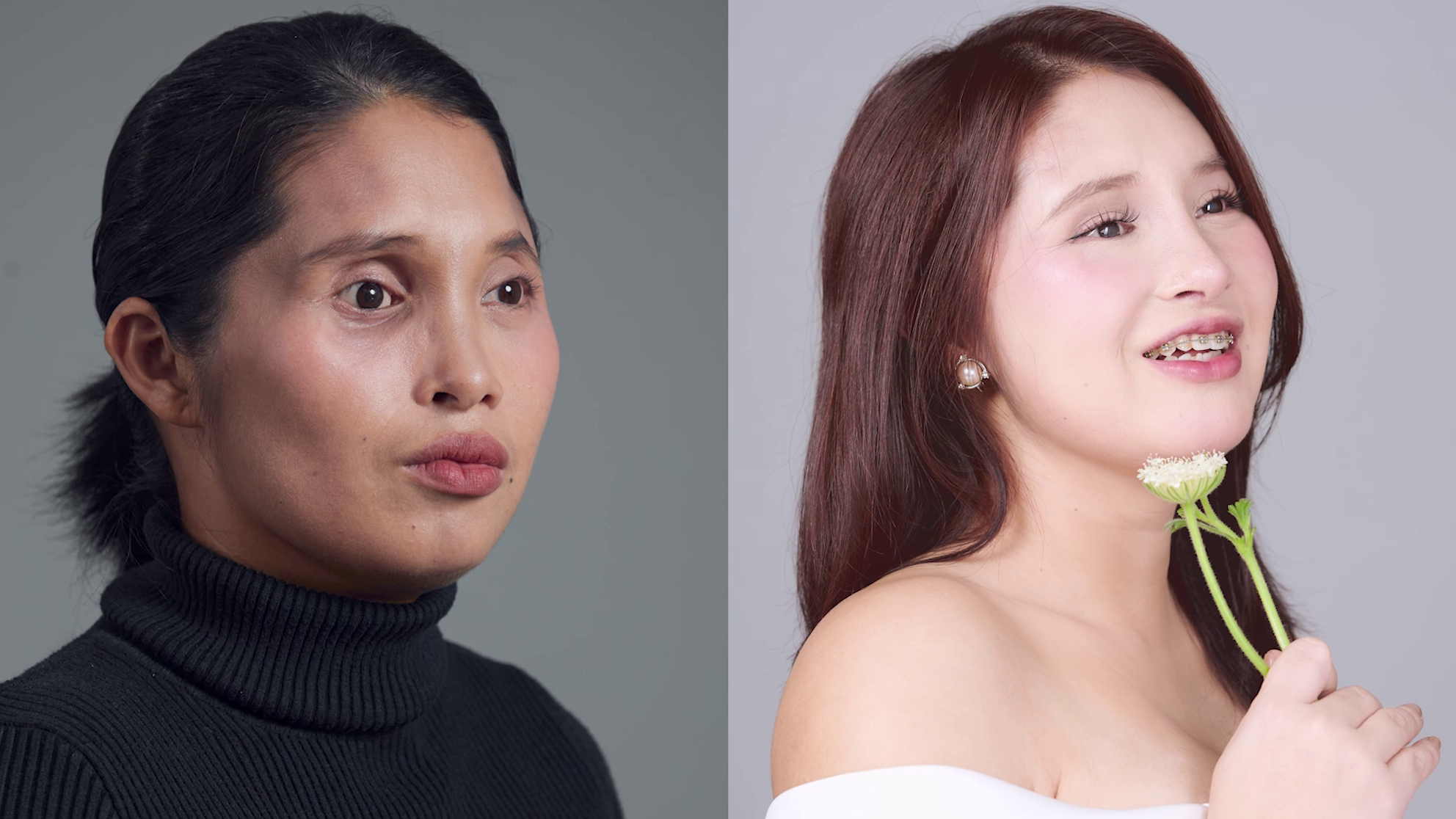 Hành trình tìm lại chính mình của cô gái già trước tuổi 30 do đột biến hiếm gặp - Ảnh 3.