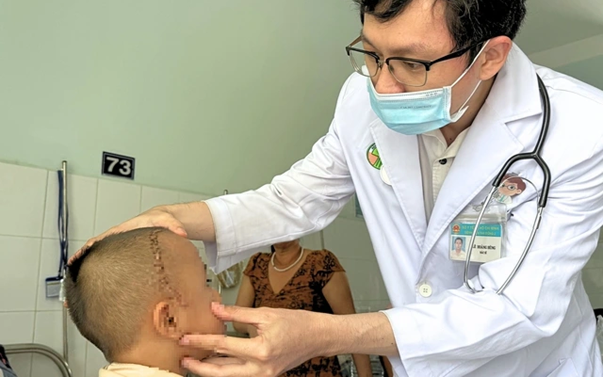 Bé trai 4 tuổi bị viên bi sắt găm vào sọ, cảnh báo nguy hiểm từ ná bắn chim