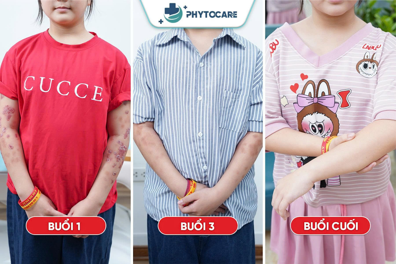 Phòng khám Da liễu PhytoCare – Địa chỉ da liễu uy tín được khách hàng tin chọn - Ảnh 4.