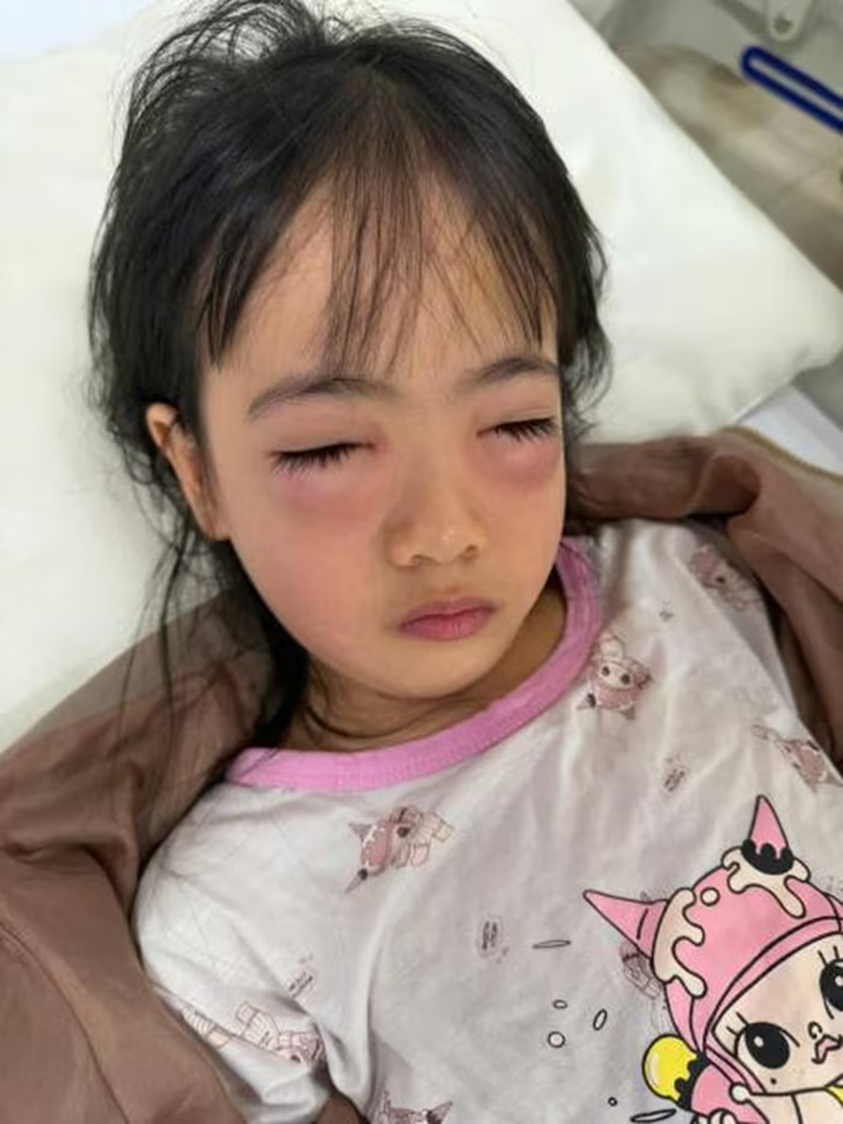 Chơi bong bóng xà phòng bé 5 tuổi phải đi cấp cứu mẹ 