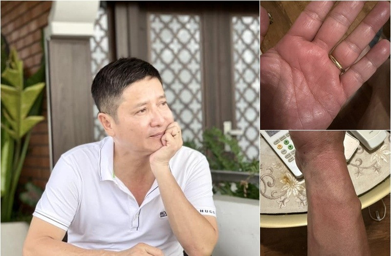 NSƯT Chí Trung mắc bệnh lạ, khiến khán giả bất ngờ - Ảnh 1.