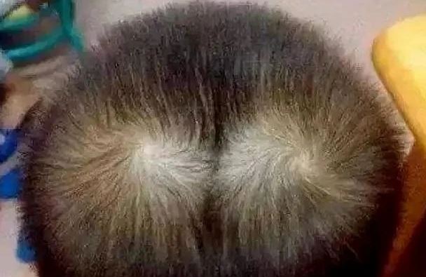 B&eacute; trai g&acirc;y "sốt mạng" v&igrave; c&oacute; tới 9 xo&aacute;y t&oacute;c v&ocirc; c&ugrave;ng hiếm gặp- Ảnh 3.
