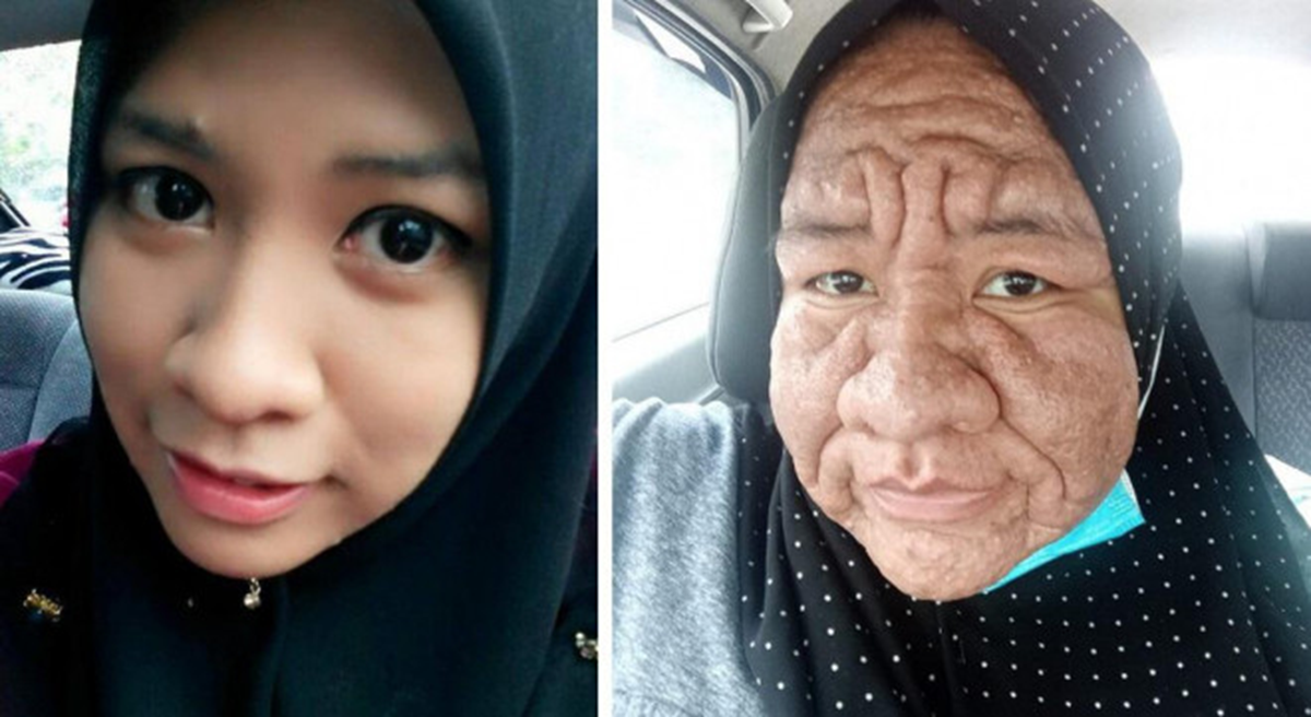 Cô gái 28 tuổi bỗng “già như cụ bà” U80: Bí ẩn phía sau gây bất ngờ - Ảnh 1.