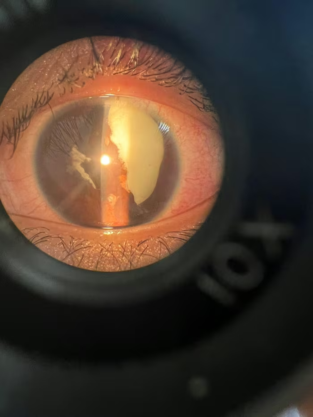 Người đàn ông 35 tuổi 
