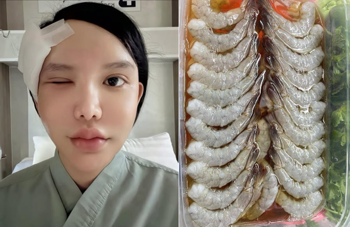 Người phụ nữ suýt mù vì ký sinh trùng ẩn náu, bác sĩ điểm mặt thói quen ăn uống 