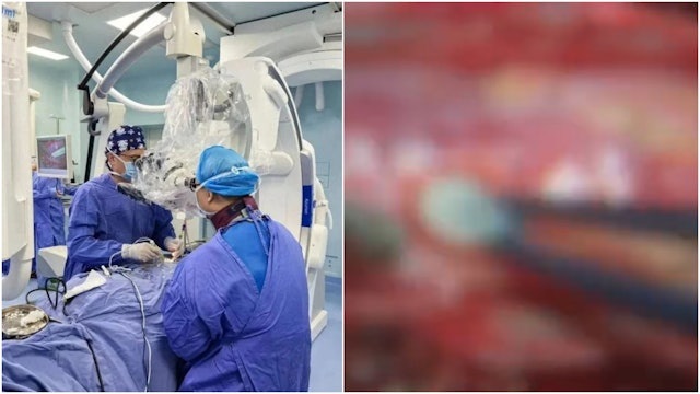 Người phụ nữ đau lưng suốt 2 năm, bác sĩ phát hiện ra bí mật