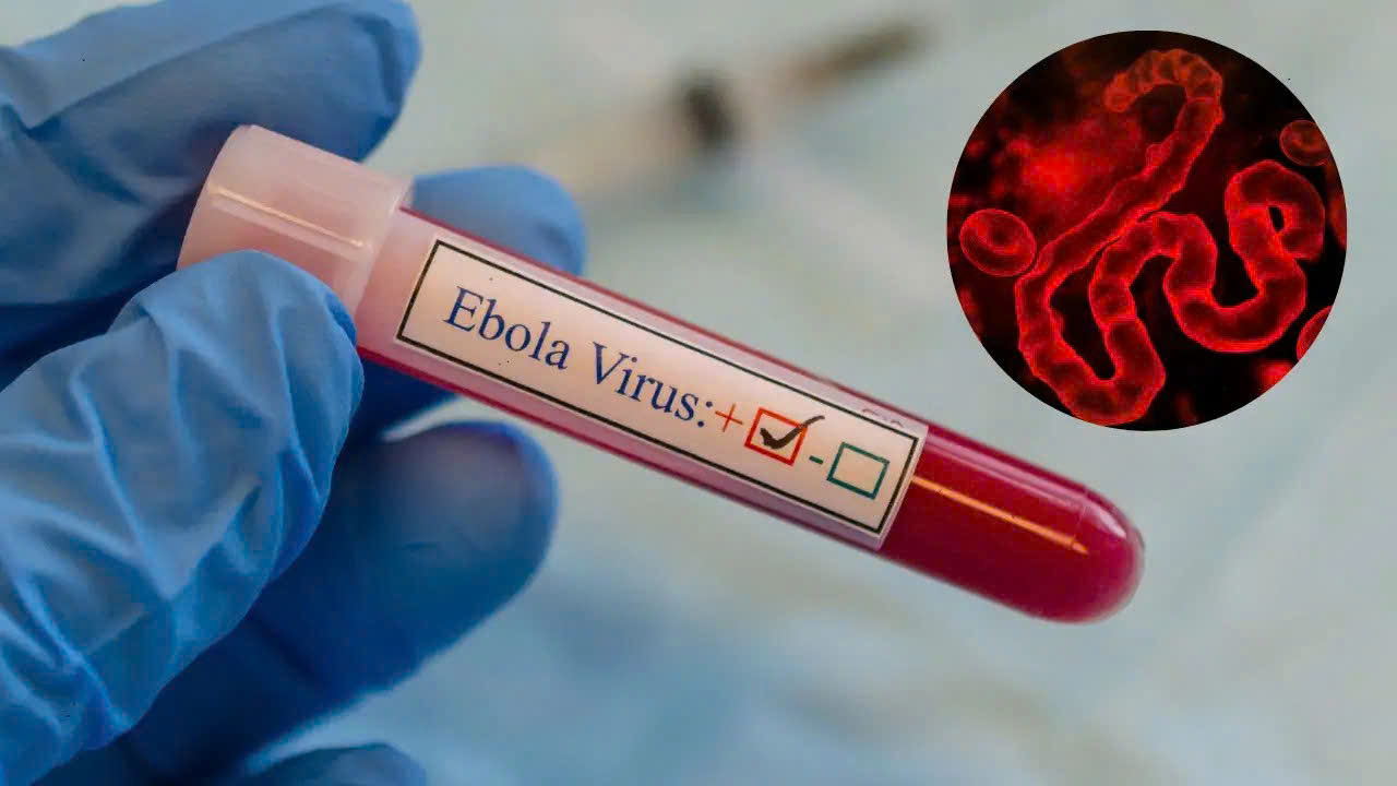 WHO: Ngành y tế chủ động, sẵn sàng hệ thống và năng lực ứng phó Ebola- Ảnh 2. WHO: Ngành y tế chủ động, sẵn sàng hệ thống và năng lực ứng phó Ebola- Ảnh 2.
