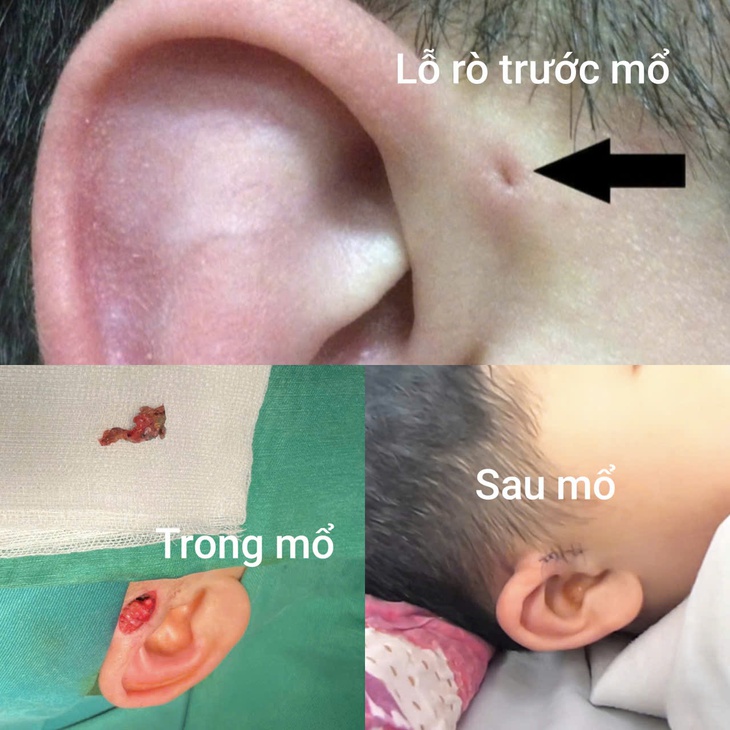 Hi hữu: 3 thế hệ nam giới trong gia đình cùng mắc dị tật ít gặp - Ảnh 1.