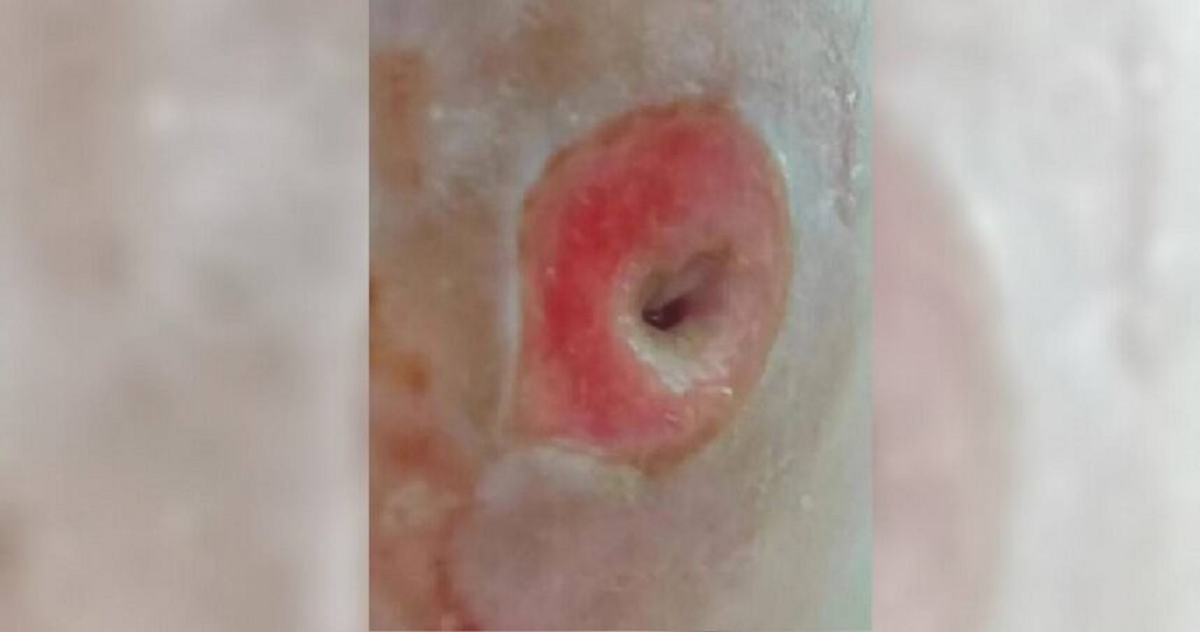 Người phụ nữ 40 tuổi chết lặng khi thấy mặt như 