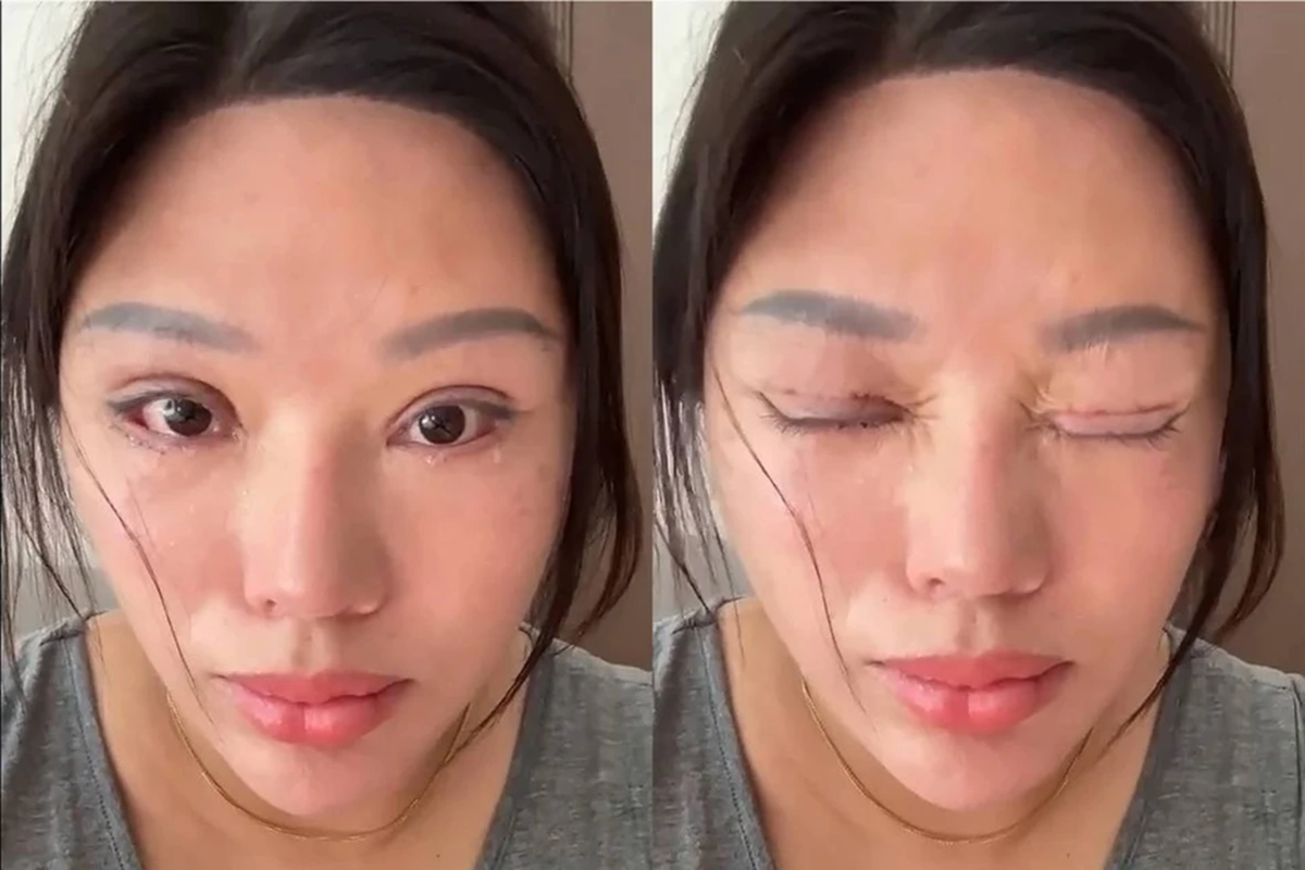 Người phụ nữ 6 năm không thể nhắm mắt khi ngủ, lý do phía sau khiến nhiều người bất ngờ - Ảnh 1.