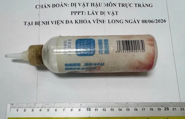 Người đàn ông 34 tuổi đau tức hậu môn, bác sĩ lấy ra thứ "đáng sợ" trong trực tràng - Ảnh 2.