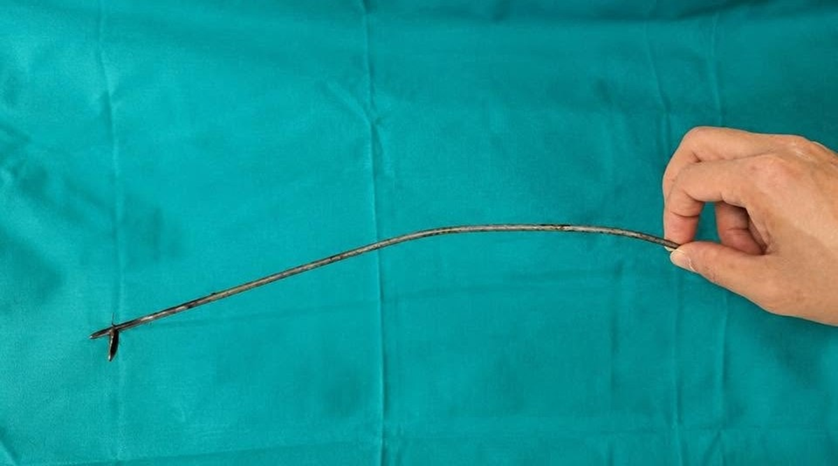 Nhập viện vì đau bất thường, nam bệnh nhân 27 tuổi khiến bác sĩ