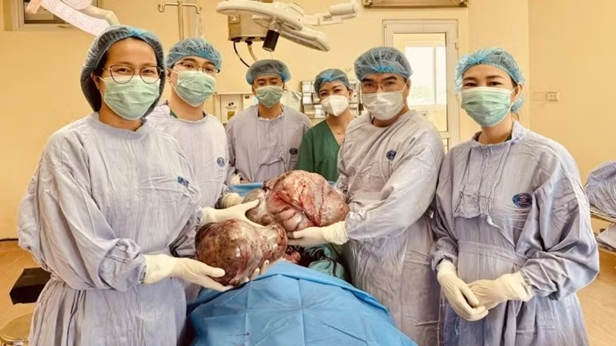 Bé gái 16 tuổi bụng to bất thường, bố mẹ sốc khi phát hiện bí mật