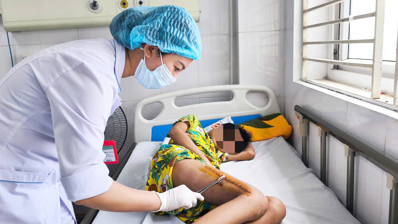 Đau hai bắp đùi sau khi chơi thể thao, bé trai rơi vào sốc nhiễm khuẩn - Ảnh 1.