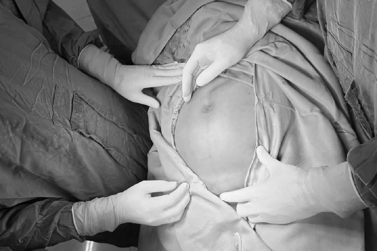 Bụng to nhanh bất thường, người phụ nữ 