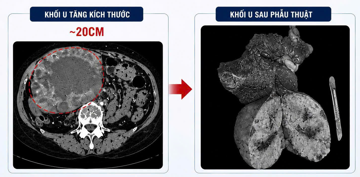 Người phụ nữ 67 tuổi nhập viện khẩn cấp, bác sĩ