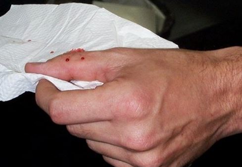 Mở kh&oacute;a xe m&aacute;y, người đ&agrave;n &ocirc;ng bị rắn độc d&agrave;i hơn 1m lao ra cắn v&agrave;o tay - Ảnh 2.