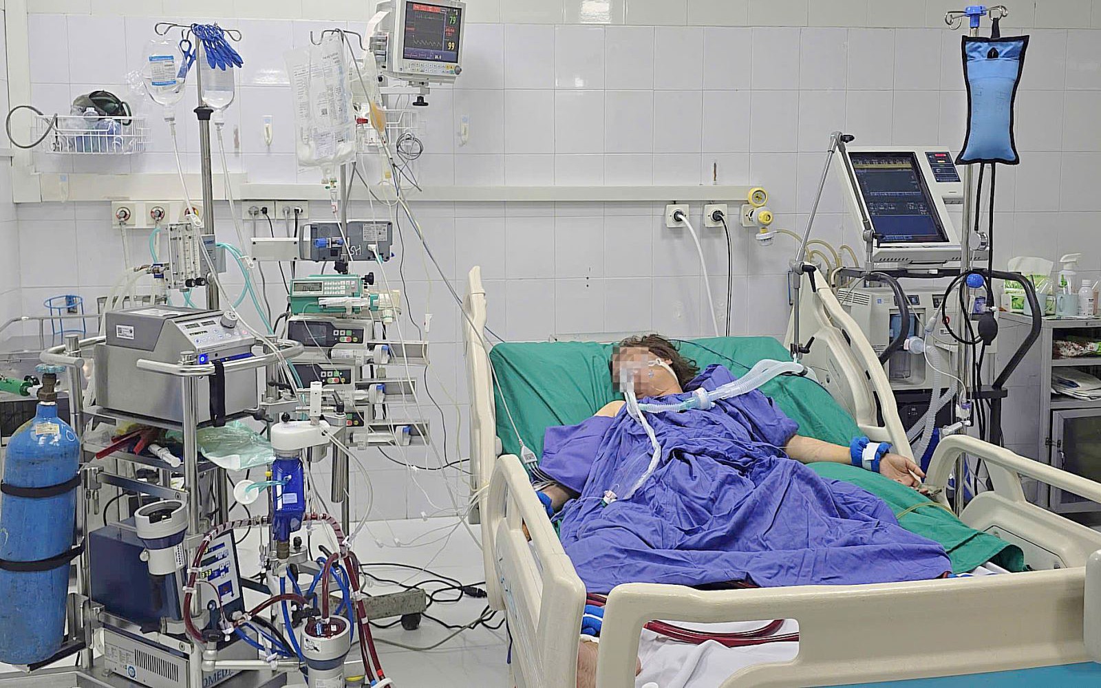 Người phụ nữ 49 tuổi nguy kịch v&igrave; một vết đốt - Ảnh 2.