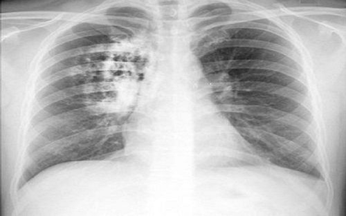 4 sai lầm khi uống nước, số 1 đang hại thận m&agrave; &iacute;t người biết - Ảnh 4.