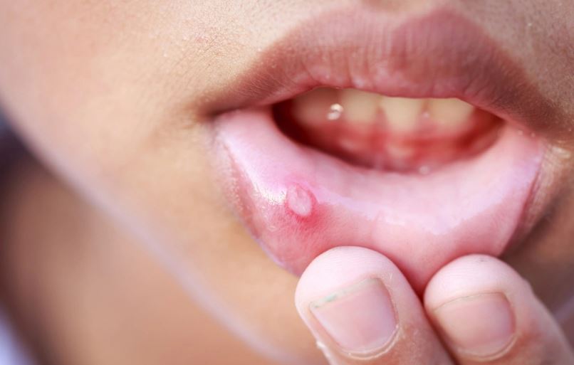 Người đàn ông 53 tuổi có dấu hiệu ung thư suốt 2 tháng mà không biết - Ảnh 1.