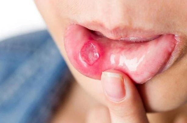 Người đàn ông 53 tuổi có dấu hiệu ung thư suốt 2 tháng mà không biết - Ảnh 2.