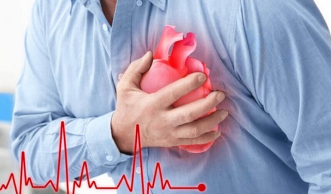 Người đàn ông 56 tuổi tử vong sau cơn đau lưng, bác sĩ cảnh báo thói quen
