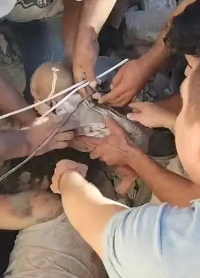Em b&eacute; sơ sinh được giải cứu khỏi đống đổ n&aacute;t sau trận động đất - Ảnh 2.