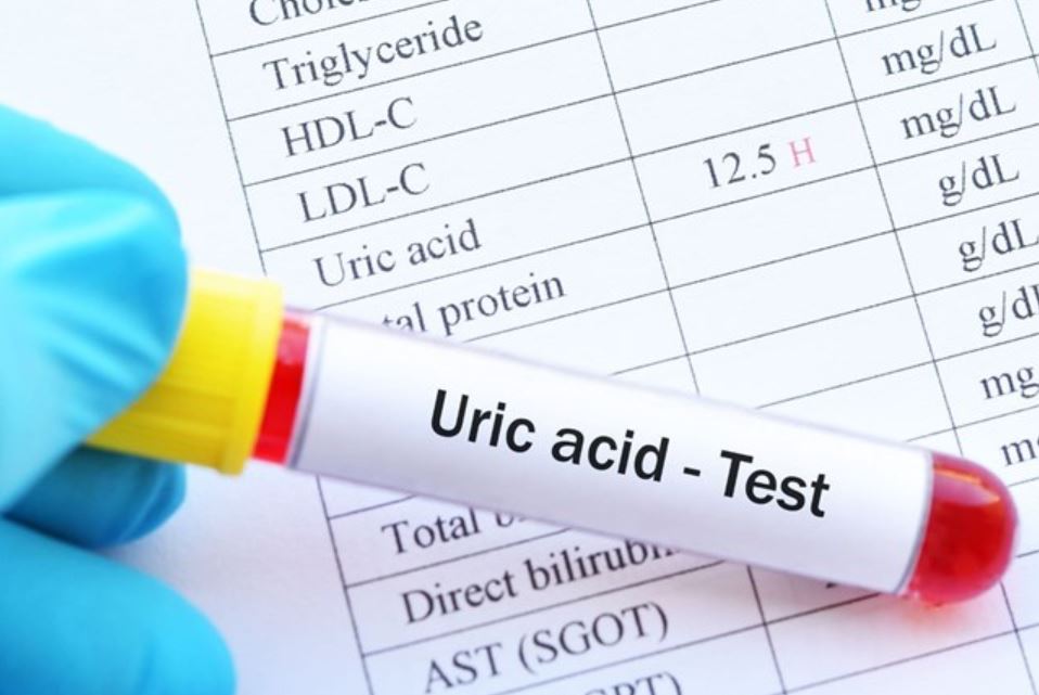 Người đàn ông 30 tuổi tử vong sau cơn đau lưng dữ dội, bác sĩ cảnh báo món 