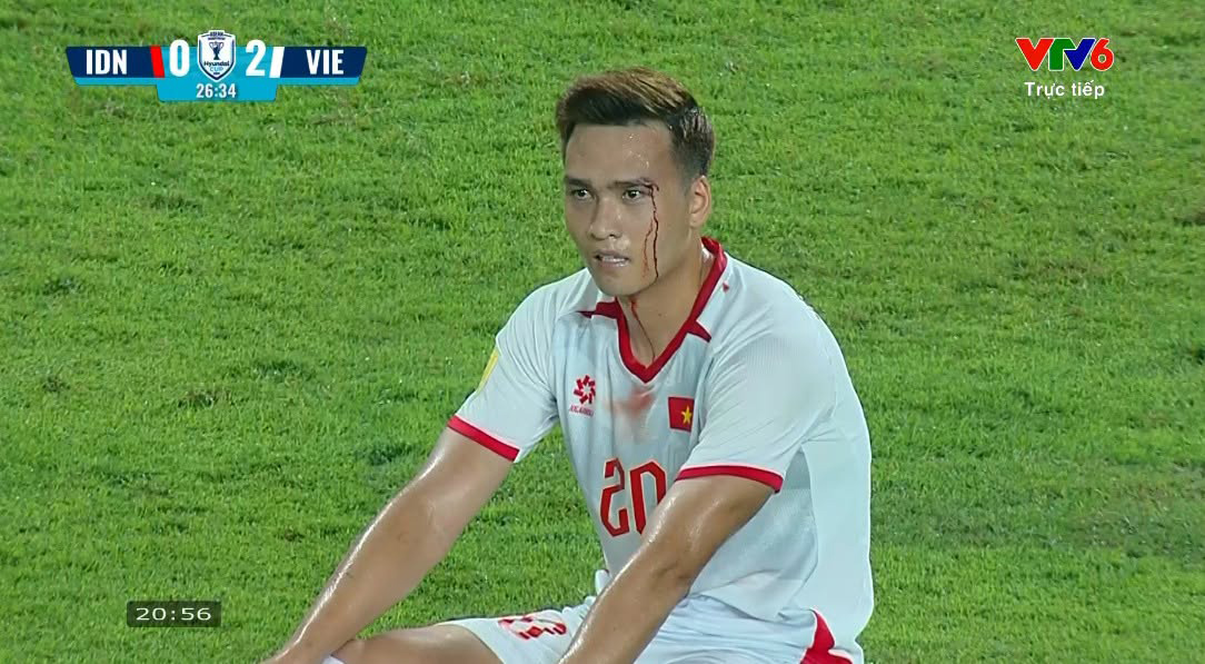 Trung vệ Bùi Hoàng Việt Anh sau khi đổ máu vẫn kiên cường thi đấu đến cuối trận - Ảnh 1.