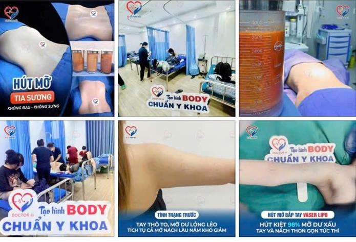 Bắt quả tang 6 người mạo danh bác sĩ gây mê, hút mỡ cho khách - Ảnh 2.