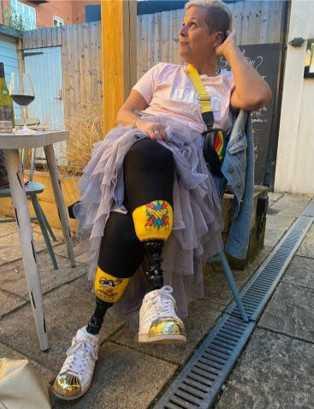 Đời sống - Tưởng bị cảm, cô gái nôn thốc nôn tháo và bị cắt cụt cả 2 chân (Hình 2).